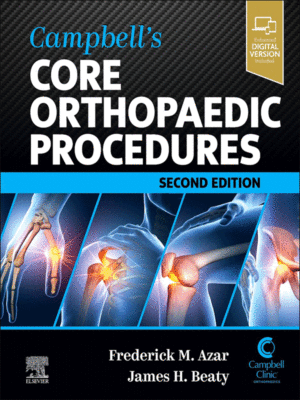 Campbell's Core Orthopaedic Procedures, 2nd Edition