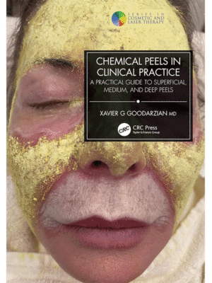 Chemical Peels in Clinical Practice: A Practical Guide to Superficial, Medium, and Deep Peels