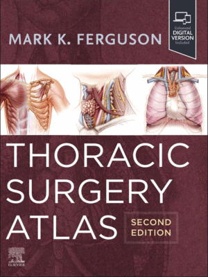 Thoracic Surgery Atlas, 2nd Edition