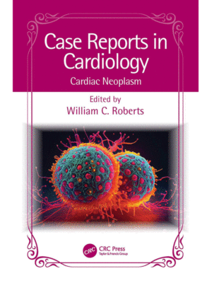 Case Reports in Cardiology: Cardiac Neoplasm