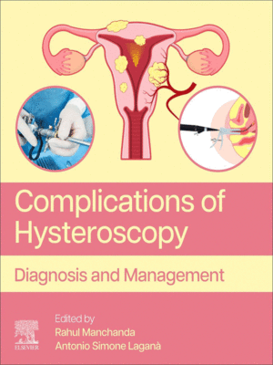 Complications of Hysteroscopy: Diagnosis and Management