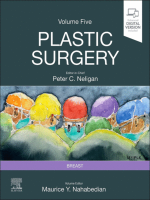Plastic Surgery: Breast, 5th Edition (Volume 5)