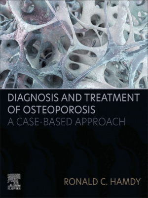 Diagnosis and Treatment of Osteoporosis: A Case-Based Approach