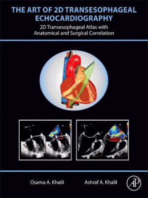 The Art of 2D Transesophageal Echocardiography: 2D Transesophageal Atlas with Anatomical and Surgical Correlation