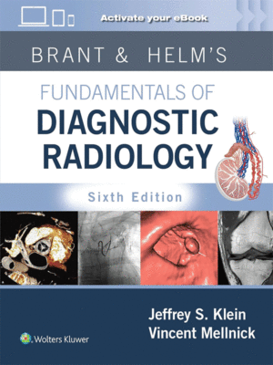 Brant & Helm's Fundamentals of Diagnostic Radiology, 6th Edition