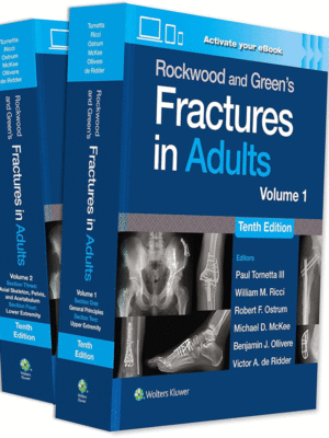 Rockwood and Green's Fractures in Adults, 2-Volume Set, 10th Edition