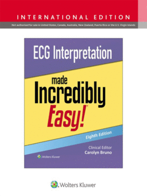 ECG Interpretation Made Incredibly Easy! (8th Edition)