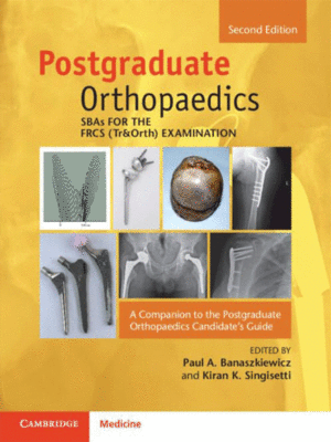 Postgraduate Orthopaedics: SBAs for the FRCS (Tr&Orth) Examination (A Companion to the Postgraduate Orthopaedics Candidate's Guide), 2nd Edition