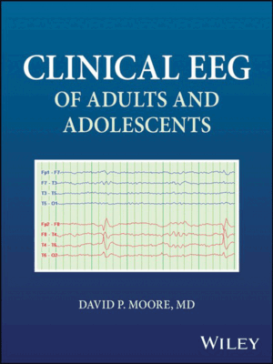 Clinical EEG of Adults and Adolescents