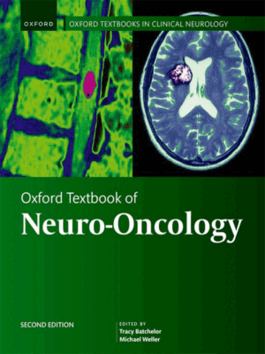 Oxford Textbook of Neuro-Oncology, 2nd Edition