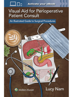 Visual Aid for Perioperative Patient Consult: An Illustrated Guide to Surgical Procedures