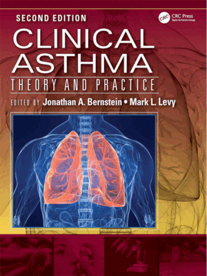 Clinical Asthma: Theory and Practice, 2nd Edition