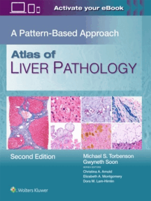 Atlas of Liver Pathology: A Pattern-Based Approach, 2nd Edition