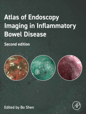 Atlas of Endoscopy Imaging in Inflammatory Bowel Disease, 2nd Edition