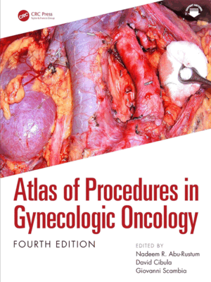 Atlas of Procedures in Gynecologic Oncology, 4th Edition