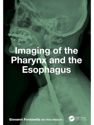 Imaging of the Pharynx and the Esophagus