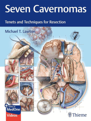 Seven Cavernomas: Tenets and Techniques for Resection