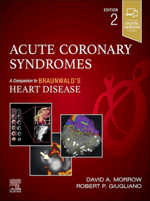 Acute Coronary Syndromes, 2nd Edition