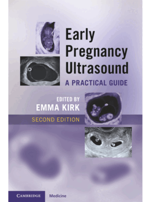 Early Pregnancy Ultrasound: A Practical Guide, 2nd Edition