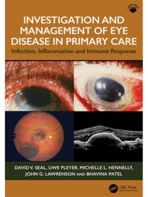 Investigation & Management of Eye Disease in Primary Care: Infection, Inflammation and Immune Response