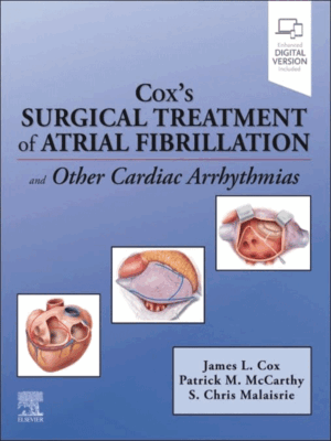 Cox’s Surgical Treatment of Atrial Fibrillation
