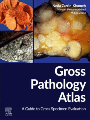 Gross Pathology Atlas: A Guide to Gross Specimens Evaluation