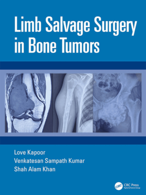 Limb Salvage Surgery in Bone Tumors