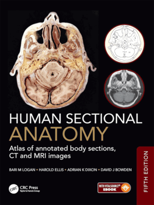 Human Sectional Anatomy: Atlas of Annotated Body Sections, CT and MRI Images, 5th Edition