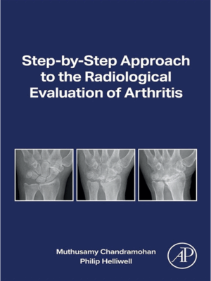 Step-by-Step Approach to the Radiological Evaluation of Arthritis
