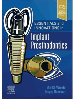 Essentials and Innovations in Implant Prosthodontics