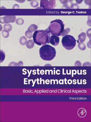 Systemic Lupus Erythematosus: Basic, Applied and Clinical Aspects, 3rd Edition