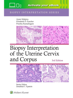 Biopsy Interpretation of the Uterine Cervix and Corpus, 3rd Edition
