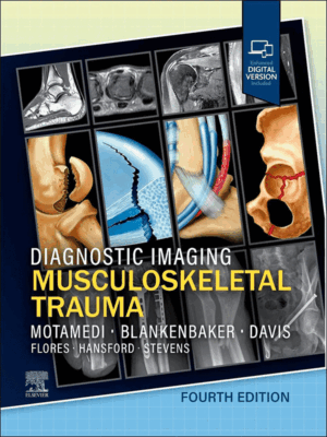 Diagnostic Imaging: Musculoskeletal Trauma, 4th Edition