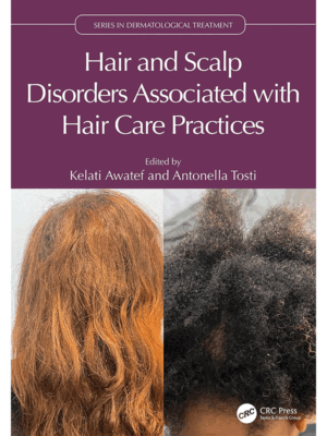 Hair and Scalp Disorders Associated with Hair Care Practices