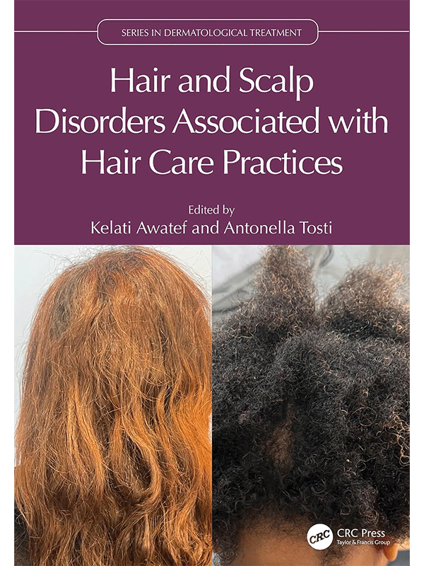 Hair and Scalp Disorders Associated with Hair Care Practices Hair and Scalp Disorders Associated with Hair Care Practices