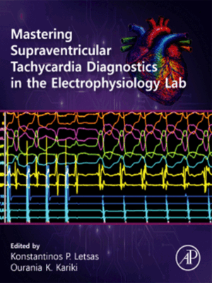 Mastering Supraventricular Tachycardia Diagnostics in the Electrophysiology Lab