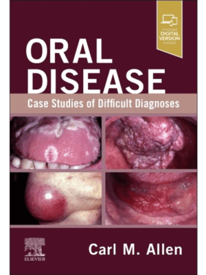 Oral Disease: Case Studies of Difficult Diagnoses