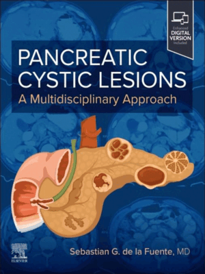 Pancreatic Cystic Lesions: A Multidisciplinary Approach