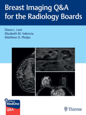 Breast Imaging Q&A for the Radiology Boards
