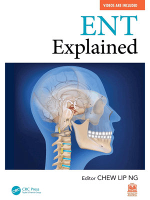 ENT Explained