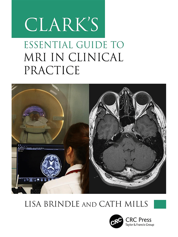 Clark's Essential Guide to MRI in Clinical Practice Clark's Essential Guide to MRI in Clinical Practice
