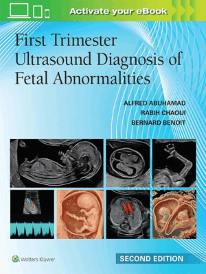 First Trimester Ultrasound Diagnosis of Fetal Abnormalities, 2nd Edition