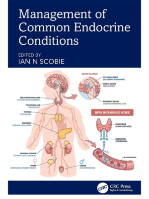 Management of Common Endocrine Conditions